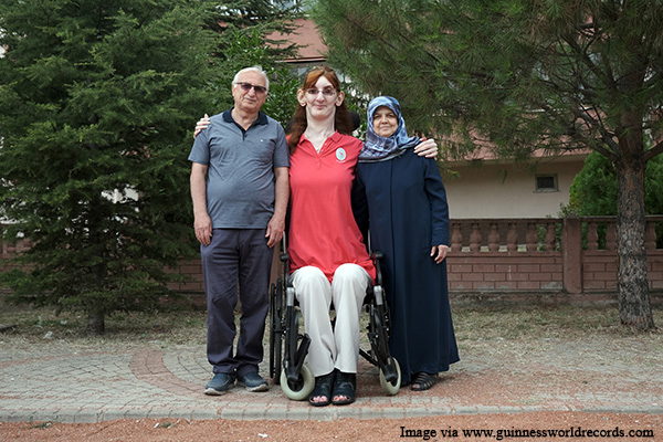 Meet Rumeysa Gelgi The Tallest Woman In The World - Irish Indian Chronicle